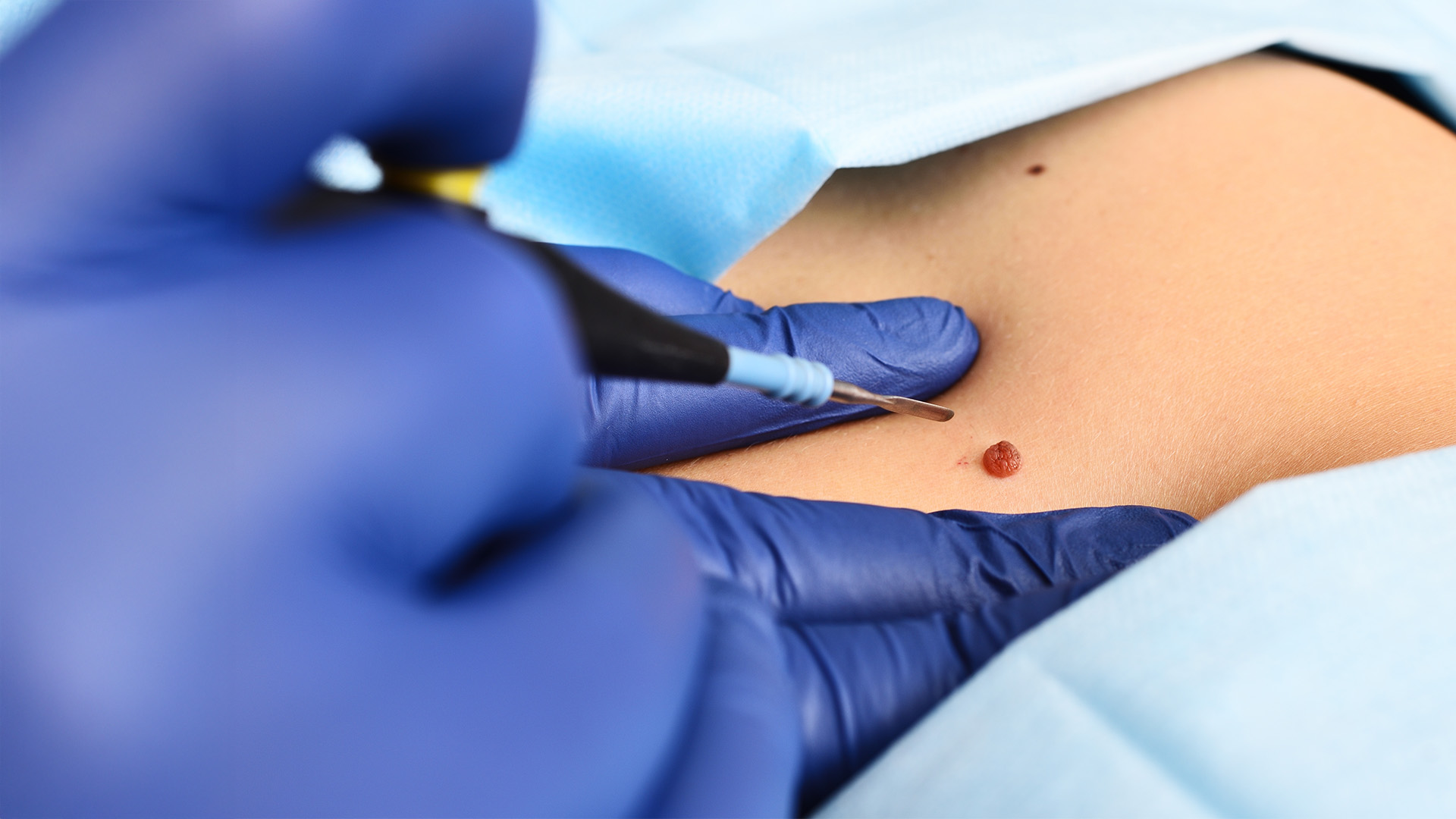 Dec 2022 - Biopsy best practice