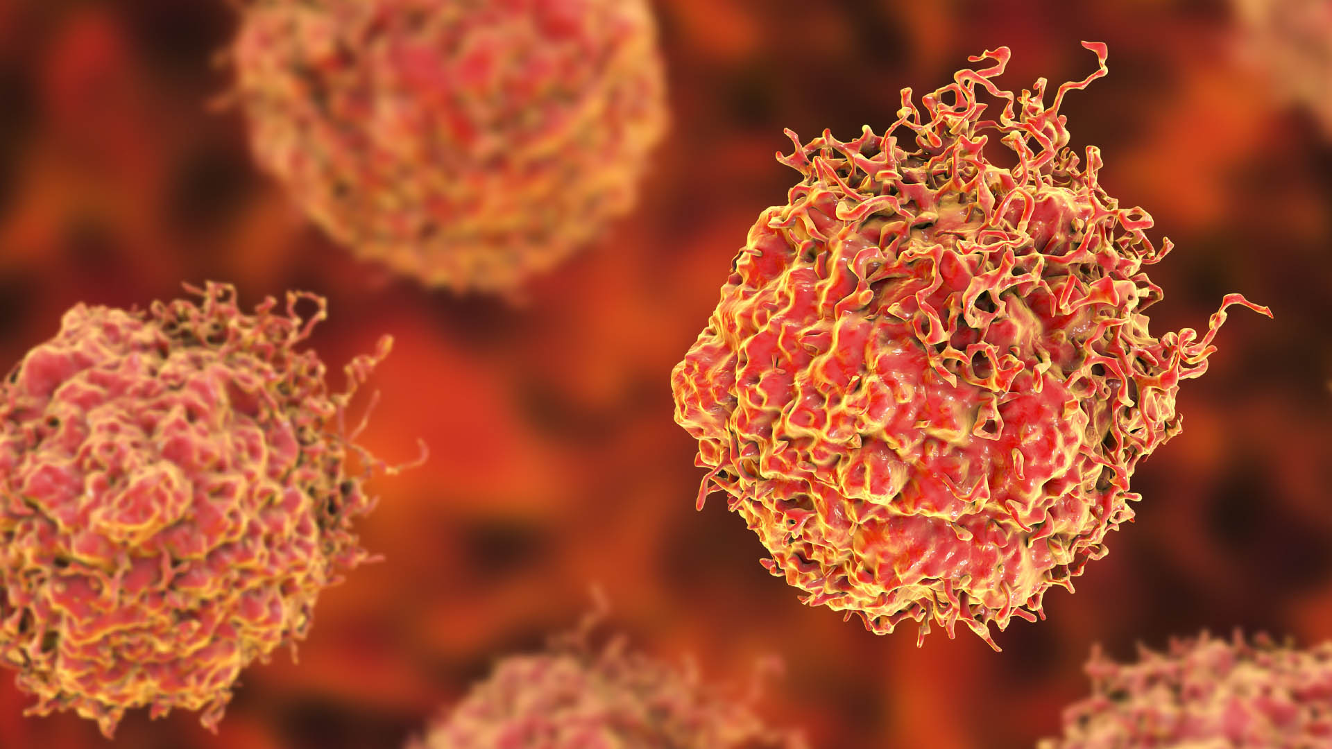 Dec 2023 - New MBS item