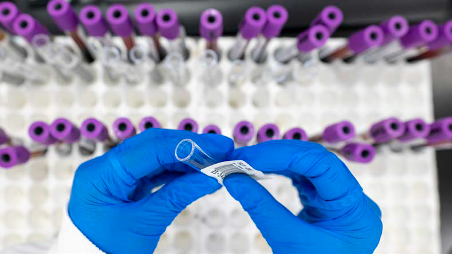 Dec 2025 - Coeliac disease HLA genotyping