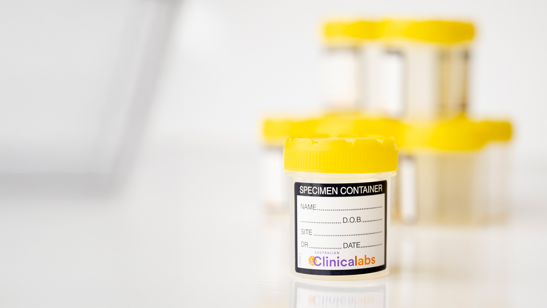 Patient Instructions - Urine