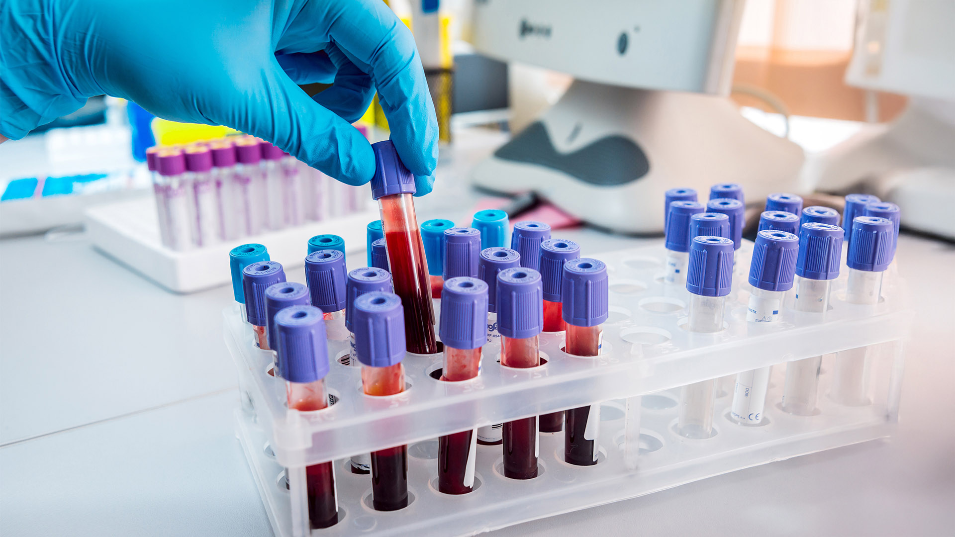 Pre-employment screening