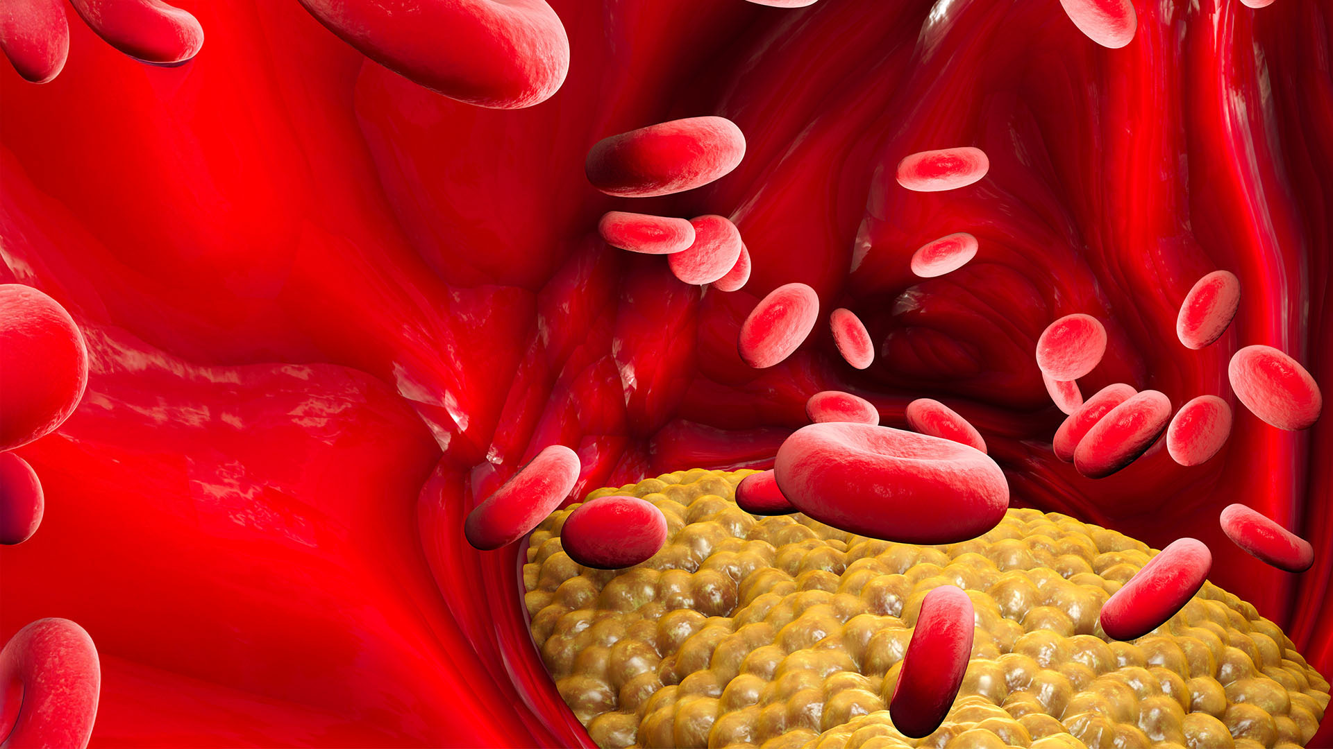 Sept 2020 - Non Fasting Lipids 