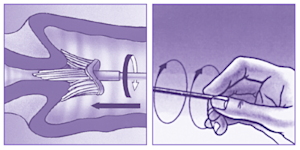 LBC ThinPrep Collect image